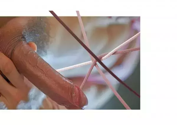 HORMONE 03 - Aran