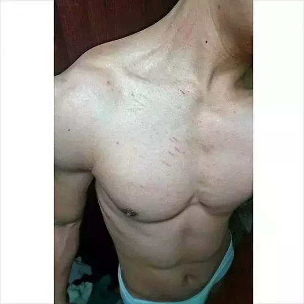 Hunger Homme | Ice Ratawit